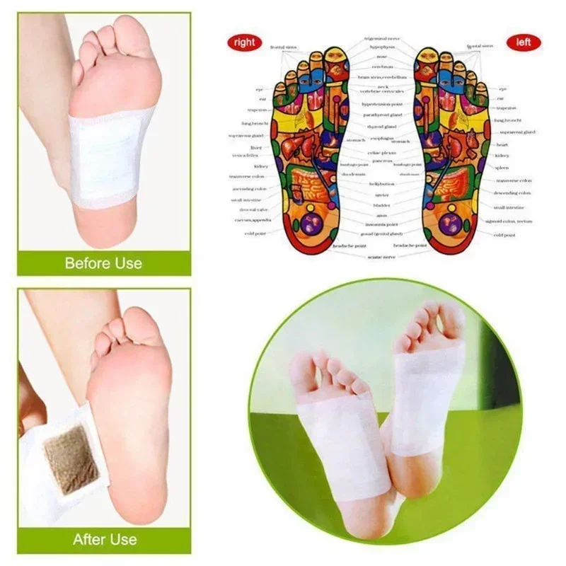 Korea Kinoki Cleansing Detox L - Health Wellness And Spa 리뷰 및 가격